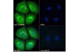Immunofluorescence (IF) image for anti-S100 Calcium Binding Protein A9 (S100A9) (Internal Region) antibody (ABIN335161)