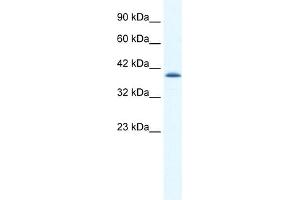 WB Suggested Anti-CATSPER2 Antibody Titration:  1. (CATSPER2 抗体  (N-Term))