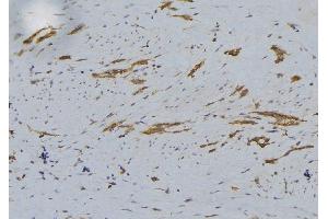 ABIN6279242 at 1/100 staining Human lung tissue by IHC-P. (CHST12 抗体  (C-Term))