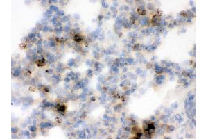 IHC analysis of Lipocalin 2 using anti-Lipocalin 2 antibody .