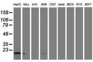 Image no. 2 for anti-NADH Dehydrogenase (Ubiquinone) 1 alpha Subcomplex, 7, 14.5kDa (NDUFA7) antibody (ABIN1499660) (NDUFA7 抗体)