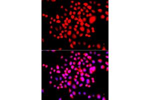 Immunofluorescence analysis of A549 cells using STK19 antibody. (STK19 抗体)