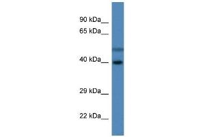 Western Blot showing HSDL1 antibody used at a concentration of 1 ug/ml against Fetal Liver Lysate (HSDL1 抗体  (C-Term))