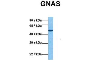 Host:  Rabbit  Target Name:  GNAS  Sample Tissue:  Human Lung Tumor  Antibody Dilution:  1.