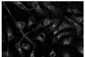 Anti-Rabia Ab at 1/500 dilution, 293 cells transfected with GFP-Rab7a, 293FT, Di7, At-T2 and 3T3, lysates at 100 per Iane, rabit polyclonal to goat lµg (HRP) at 1/10,000 dilution, (RAB14 抗体  (C-Term))