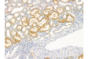 ABIN6264423 and ABIN6276412 at 1/100 staining human normal kidney tissue by IHC-P.