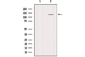Western Blotting (WB) image for anti-Glutamate Receptor, Ionotropic, N-Methyl D-Aspartate 1 (GRIN1) (C-Term) antibody (ABIN6263664)