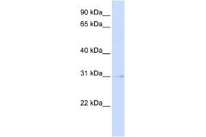 PVRIG antibody used at 1 ug/ml to detect target protein. (PVRIG 抗体  (Middle Region))