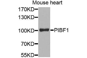 Western blot analysis of extracts of mouse heart, using PIBF1 antibody. (PIBF1 抗体)