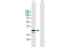 Western Blot analysis of SPSB1 expression in transfected 293T cell line by SPSB1 MaxPab polyclonal antibody. (SPSB1 抗体  (AA 1-273))