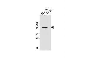 All lanes : Anti-CK2D (CK2 delta) Antibody (C-term) at 1:1000 dilution Lane 1: Mouse brain tissue lysate Lane 2: Rat brain tissue lysate Lysates/proteins at 20 μg per lane. (CAMK2D 抗体  (C-Term))