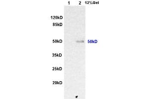 L1 rat kidney lysates L2 human colon carcinoma lysates probed with Anti ILK-1 Polyclonal Antibody, Unconjugated (ABIN727800) at 1:200 overnight at 4 °C. (ILK 抗体  (AA 301-400))