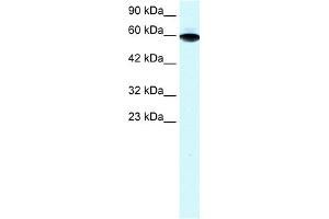 WB Suggested Anti-ZFP67 Antibody Titration:  1. (ZBTB7B 抗体  (Middle Region))