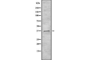 Western blot analysis of TAS2R40 using 293 whole cell lysates (TAS2R40 抗体  (Internal Region))