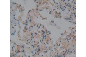 IHC-P analysis of Human Tissue, with DAB staining. (NBL1 抗体  (AA 17-181))