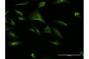 Immunofluorescence of monoclonal antibody to ATF6B on HeLa cell. (ATF6B 抗体  (AA 2-88))