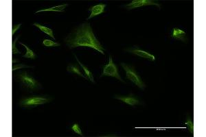 Immunofluorescence of monoclonal antibody to ATF6B on HeLa cell.