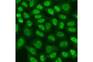 Immunofluorescence analysis of U2OS cells using TERF2IP antibody (ABIN6293618) at dilution of 1:100. (RAP1 抗体)