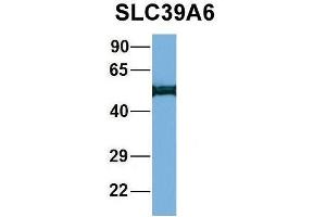 Western Blotting (WB) image for anti-Solute Carrier Family 39 (Zinc Transporter), Member 6 (SLC39A6) (Middle Region) antibody (ABIN2781630)