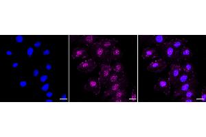 Immunocytochemical staining of H9C2 cells with Phospho-PAK4 + PAK5 + PAK6 (S474 + S560 + S602) antibody (ABIN7799729), 1:1,000).