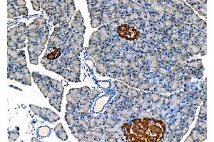 ABIN6262752 and ABIN6278170 at 1/100 staining Rat pancreatic tissue by IHC-P.