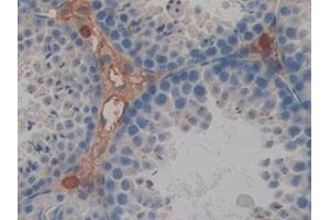 Immunohistochemistry (IHC) image for anti-Galectin 4 (LGALS4) (AA 1-326) antibody (ABIN7431572)