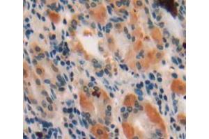 Used in DAB staining on fromalin fixed paraffin-embedded stomach tissue (WISP1 抗体  (AA 216-347))