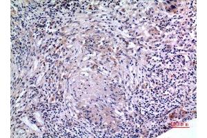 Immunohistochemistry (IHC) analysis of paraffin-embedded Human Lung, antibody was diluted at 1:100. (IL-6 抗体  (Internal Region))
