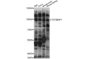 Western blot analysis of extracts of various cell lines, using TGFBRAP1 antibody (ABIN6292312) at 1:1000 dilution. (TGFBRAP1 抗体)