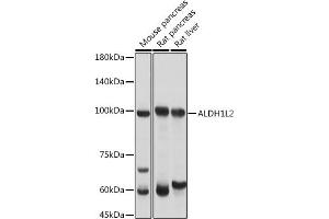 Western blot analysis of extracts of various cell lines, using L2 antibody (ABIN7265536) at 1:3000 dilution. (ALDH1L2 抗体  (AA 280-480))