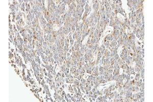 IHC-P Image Immunohistochemical analysis of paraffin-embedded BT483 xenograft, using EIF3F, antibody at 1:100 dilution. (EIF3F 抗体)
