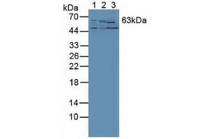 Western blot analysis of (1) Human PC-3 Cells, (2) Human Liver Tissue and (3) Mouse Kidney Tissue.