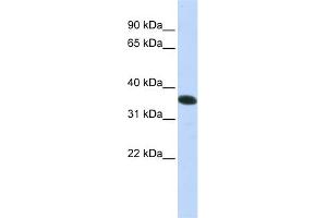 WB Suggested Anti-C21orf59 Antibody Titration:  0. (C21orf59 抗体  (N-Term))