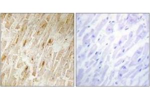 Immunohistochemistry analysis of paraffin-embedded human heart tissue, using BCA3 Antibody. (AKIP1 抗体  (AA 111-160))