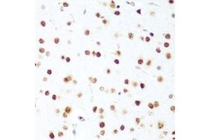 Immunohistochemistry (Paraffin-embedded Sections) (IHC (p)) image for anti-Cyclin-Dependent Kinase 1 (CDK1) (AA 1-297) antibody (ABIN6138247)