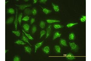 Immunofluorescence of monoclonal antibody to UBE2G1 on HeLa cell. (UBE2G1 抗体  (AA 1-170))