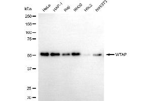 anti-Wilms Tumor 1 Associated Protein (WTAP) antibody