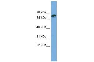 WB Suggested Anti-ZNF790 Antibody Titration:  0.