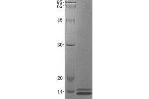 Western Blotting (WB) image for serine Peptidase Inhibitor, Kazal Type 1 (SPINK1) protein (ABIN2732592)