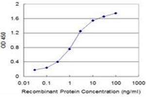 Detection limit for recombinant GST tagged TARBP2 is approximately 0. (TARBP2 抗体  (AA 141-250))