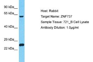 Host: Rabbit Target Name: ZNF737 Sample Type: 721_B Whole Cell lysates Antibody Dilution: 1. (ZNF737 抗体  (N-Term))