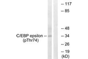 Western blot analysis of extracts from HuvEc cells treated with UV 15', using C/EBP-epsilon (Phospho-Thr74) Antibody. (CEBPE 抗体  (pThr74))