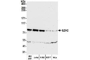 Western Blotting (WB) image for anti-Enhancer of Zeste Homolog 2 (EZH2) (AA 696-746) antibody (ABIN7450991) (EZH2 抗体  (AA 696-746))