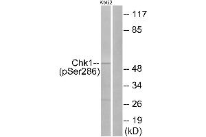 Western blot analysis of extracts from K562 cells, treated with Na3VO4 (0. (CHEK1 抗体  (pSer286))