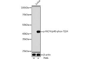 Western blot analysis of extracts of Jurkat cells, using Phospho-NCF4/p40-phox-T154 antibody (ABIN7268901) at 1:1000 dilution. (NCF4 抗体  (pThr154))