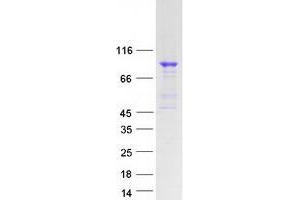 Validation with Western Blot