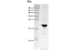 Recombinant p300 (1041-1161) protein gel. (p300 Protein (AA 1041-1161) (His tag,DYKDDDDK Tag))