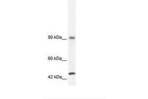 Image no. 3 for anti-RNA Binding Motif Protein 10 (RBM10) (AA 39-88) antibody (ABIN202954) (RBM10 抗体  (AA 39-88))