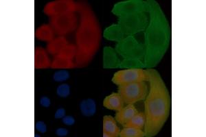 ABIN6258071 and ABIN6273747 staining Hela cells(30 min of UV treatment) by IF/ICC.