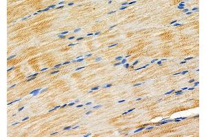 ABIN6266289 and ABIN6277345 at 1/100 staining Rat muscle tissue by IHC-P. (USO1 抗体  (C-Term))